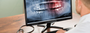 Absolute Dental Vancouver x-ray