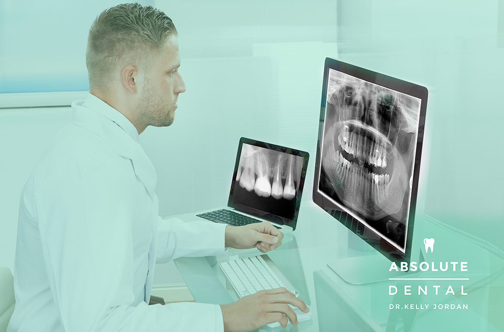 X-rays: A Necessity For Your Oral Health