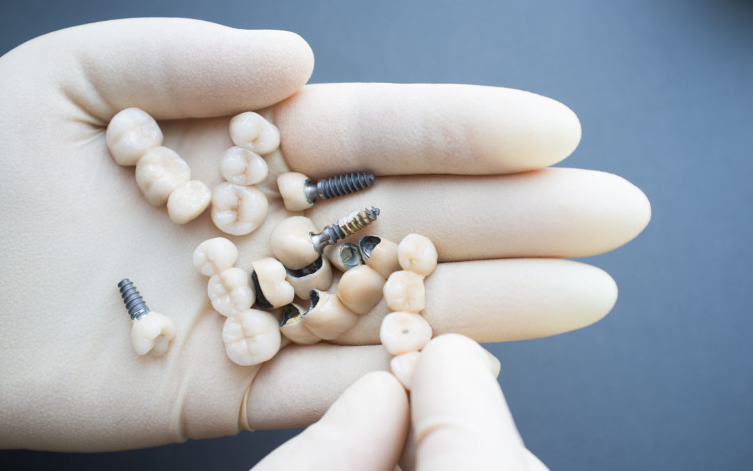 Dental Implants You Can Depend On
